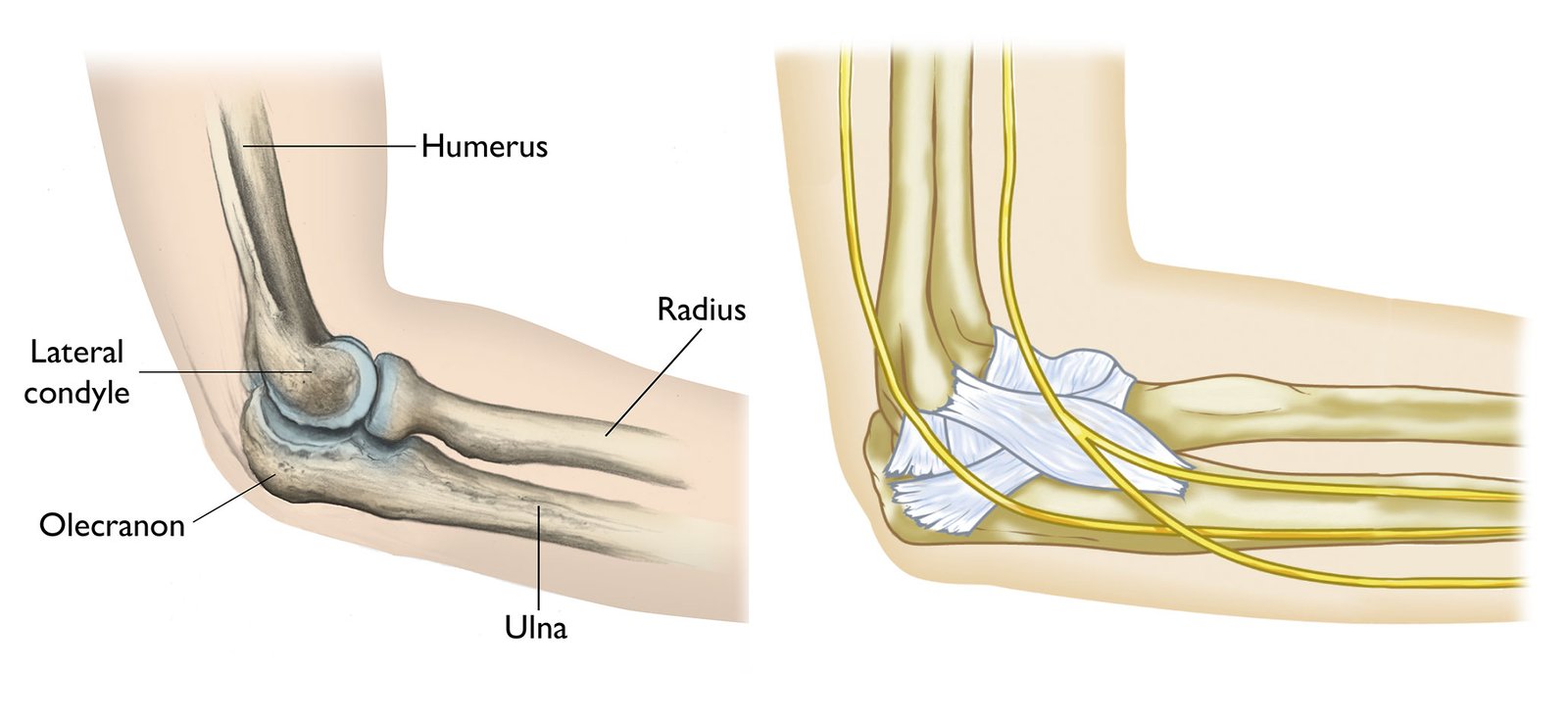 What is an Elbow Fracture?