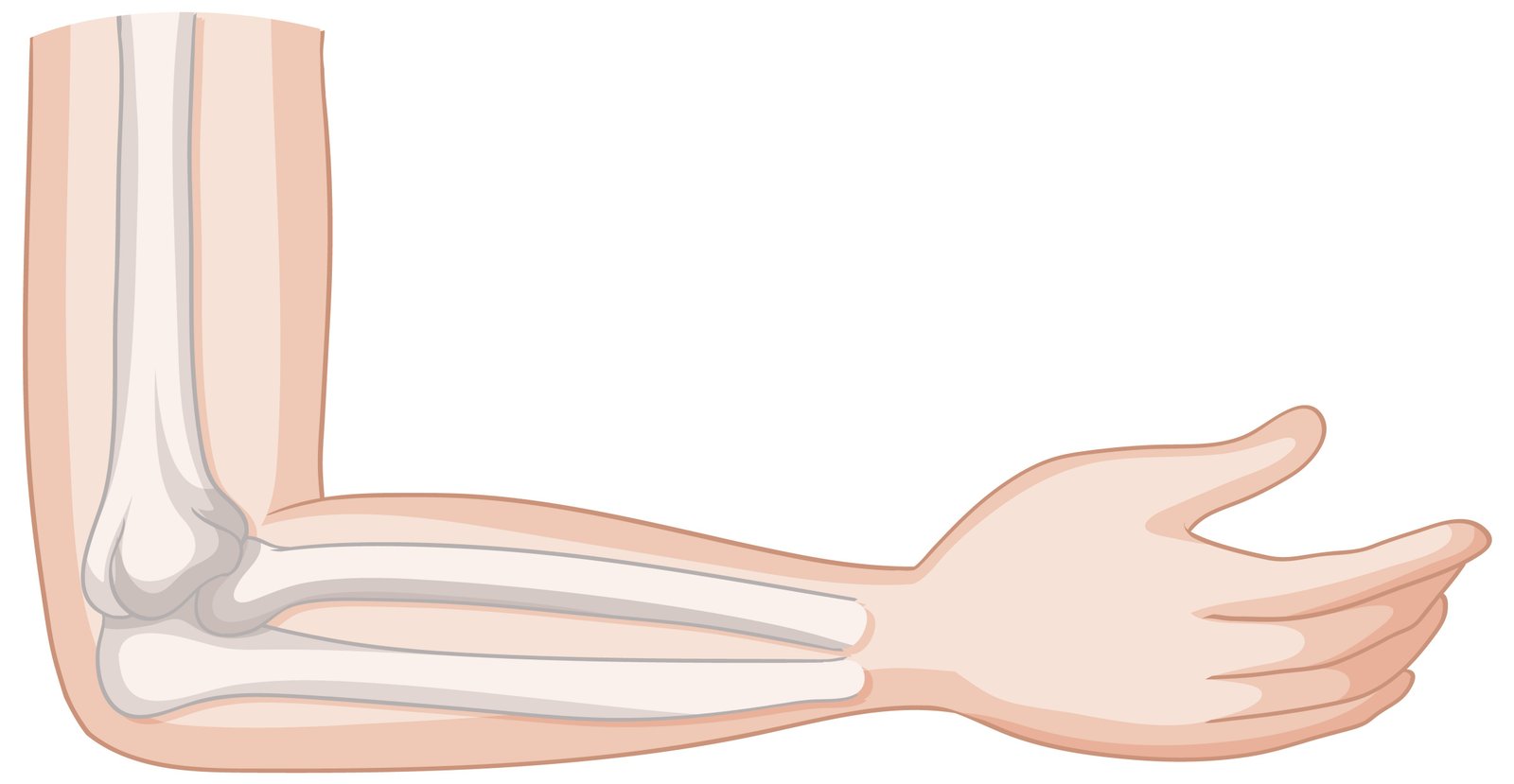 What is Elbow Stiffness?