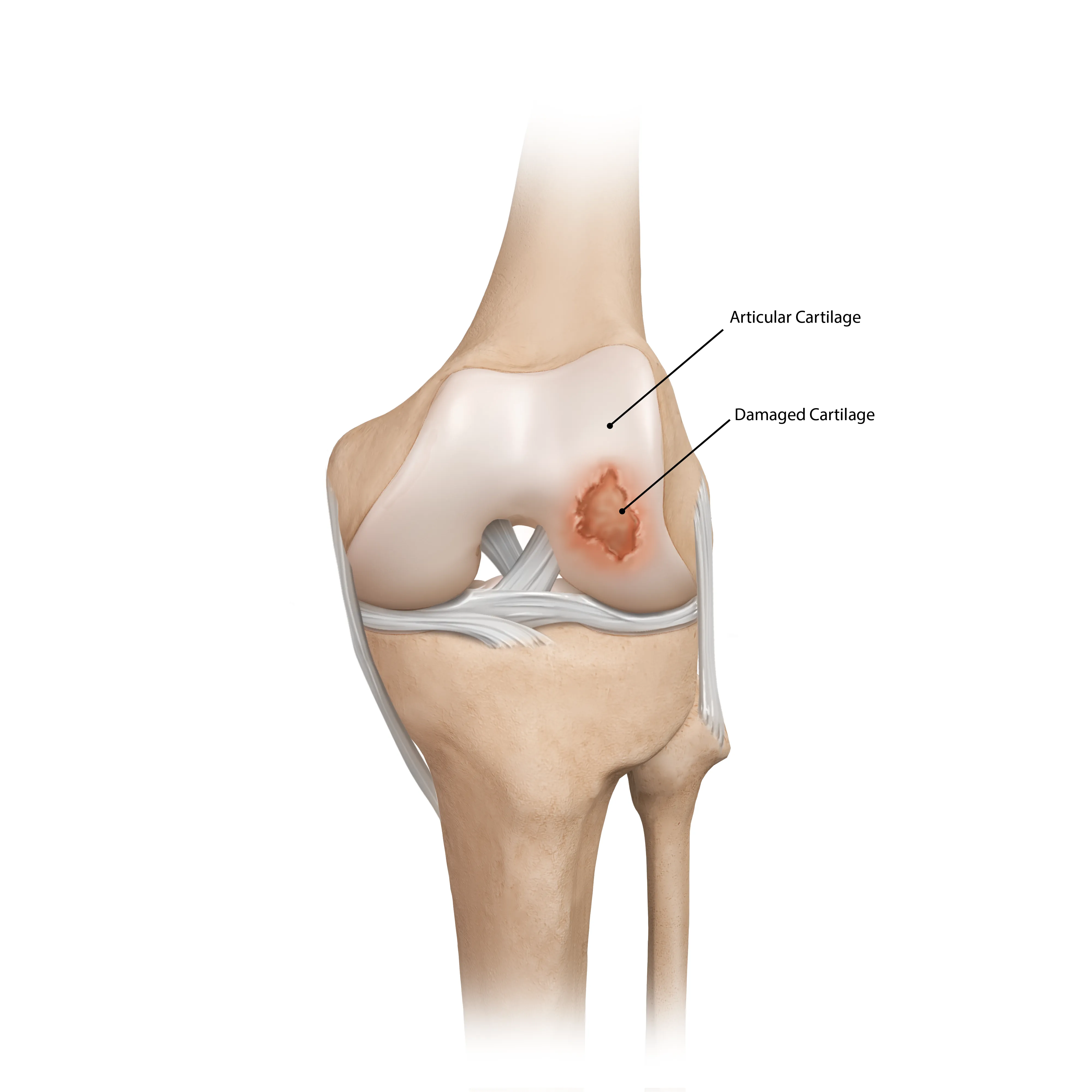 How does it get injured?