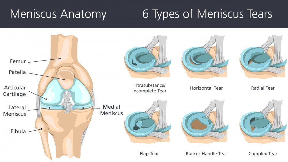 What is Meniscus?